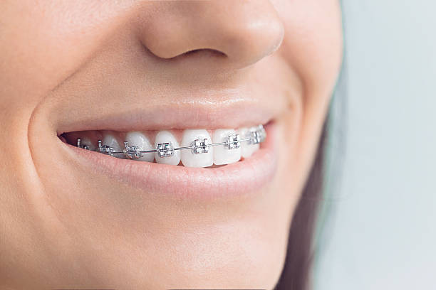 Best Veneers and Lumineers  in Manhattan, KS